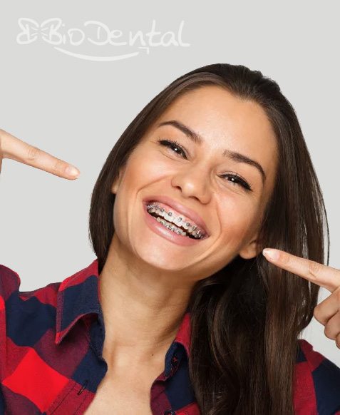 Cierre de Espacios entre Dientes sin Prótesis en Puebla