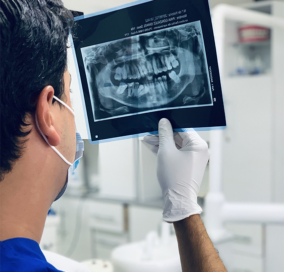 Dentistas en Puebla Biodental