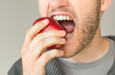 Cierre de Espacios entre Dientes sin Prótesis en Puebla