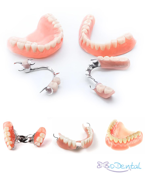 Diseño de Prótesis Dentales en Puebla