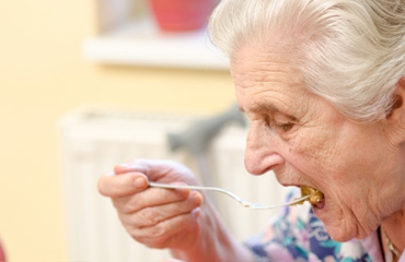 Diseño de Prótesis Dentales en Puebla