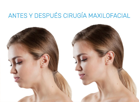 Cirugías de Especialidad Dental en Puebla