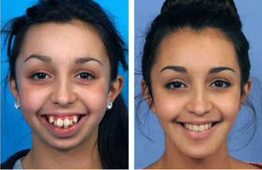 Cirugías de Especialidad Dental en Puebla