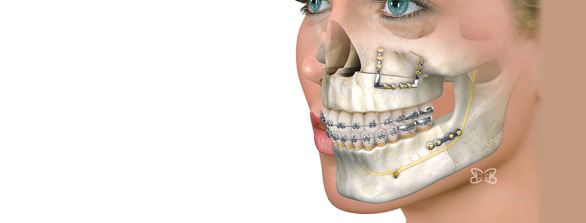 Cirugías de Especialidad Dental en Puebla