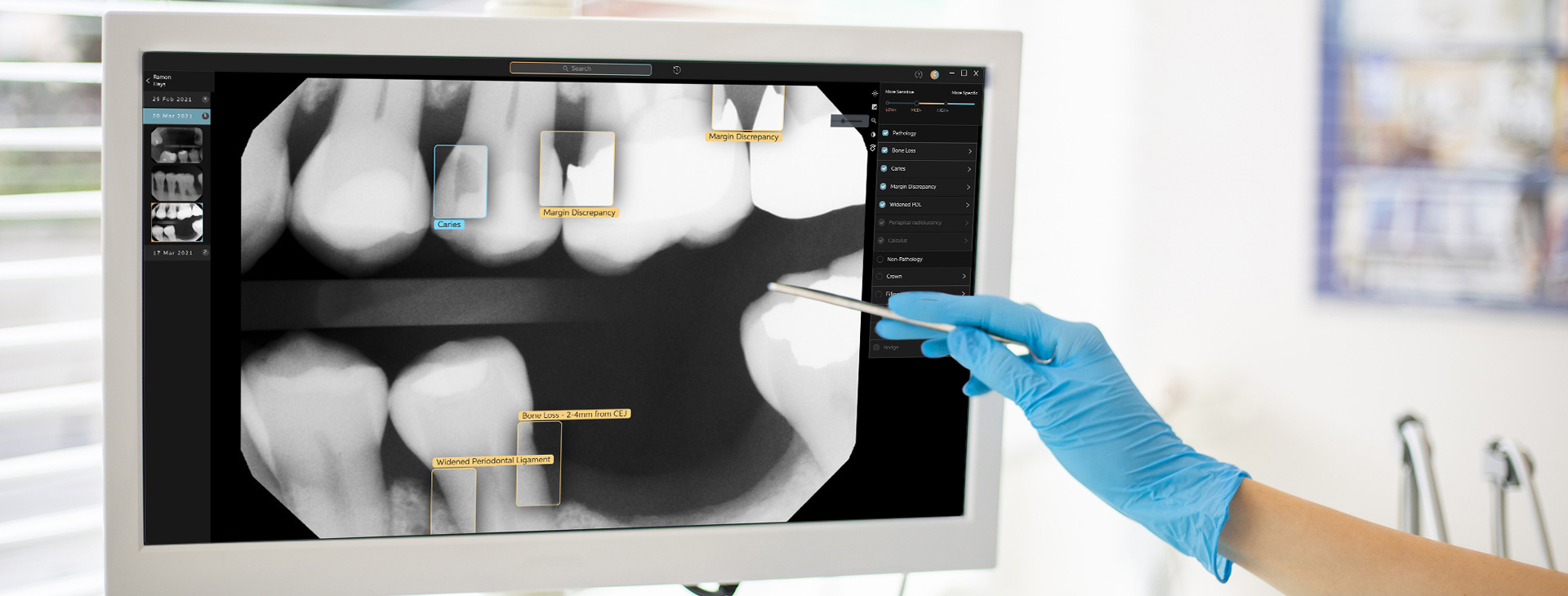 Rayos X Dentales Digitales en Puebla