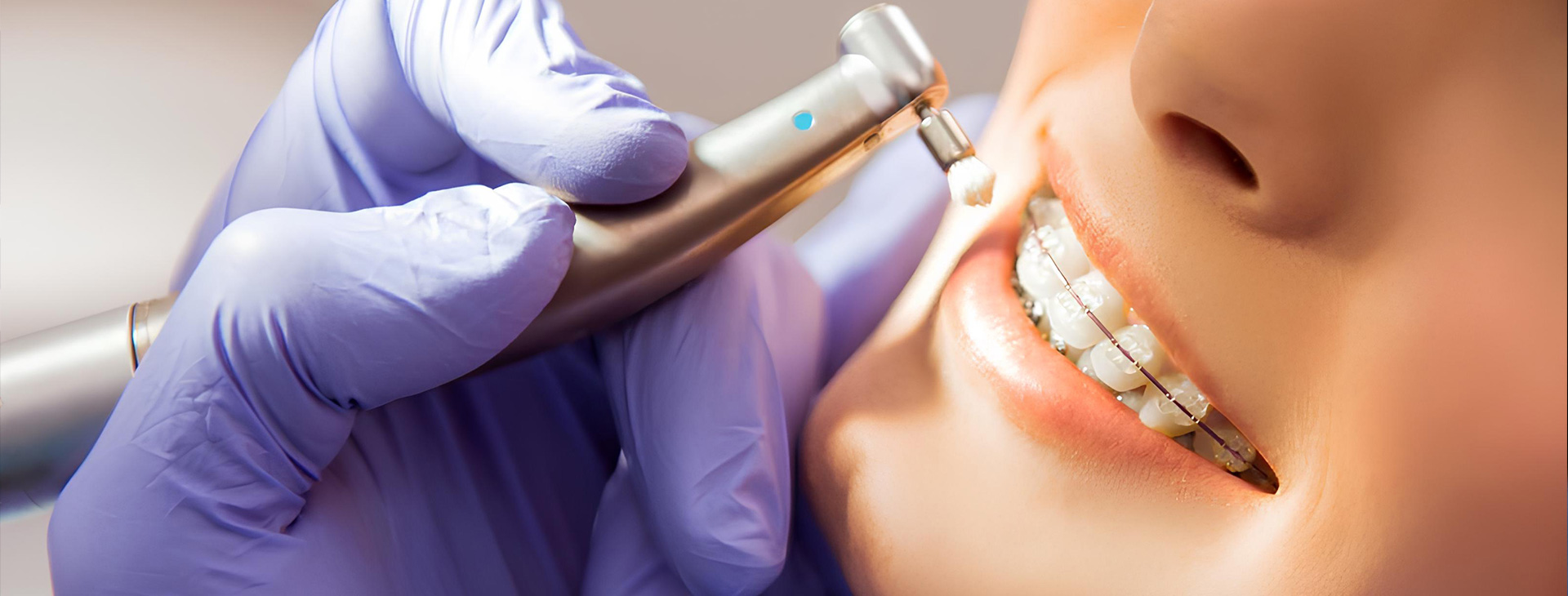 Servicios de Prevención Dental en Puebla